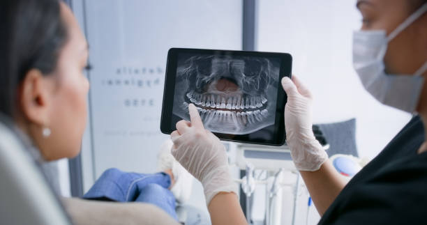 Licensed Tooth Extraction service in St. George, UT - Smile Center Dentistry